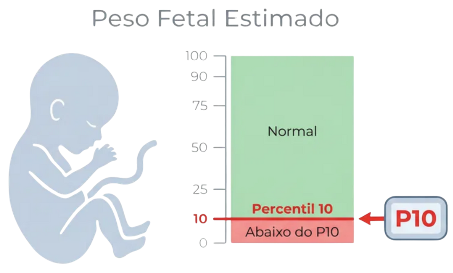 Ilustração - Peso Fetal Estimado e Percentil 10